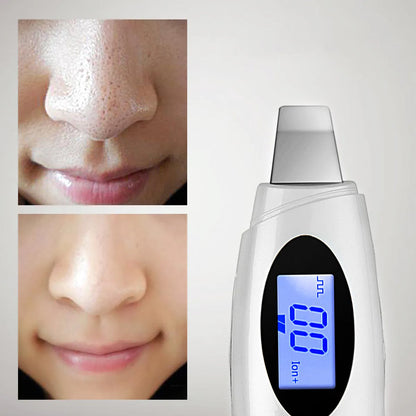 Star silver ultrasonic beauty instrument with adjustable vibration, plug charging, and fixed brush head