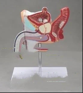 Male reproductive pathology anatomical model showing diseases in plastic construction