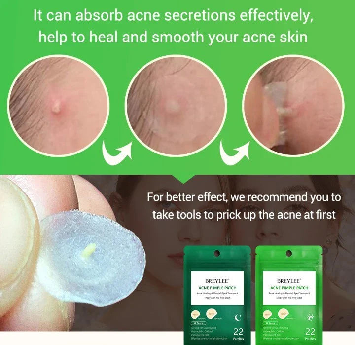 Tea Tree Acne Patches: Transparent, Ultra-Thin Design to Effectively Treat Blemishes and Fade Marks