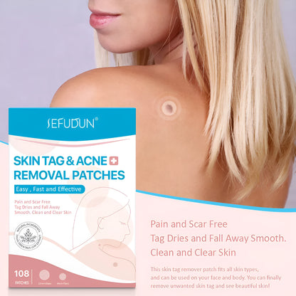 108 white vitamin A skin tag remover patches for wart and acne care at home