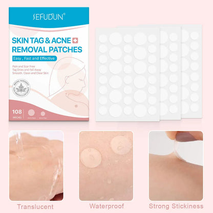 108 white vitamin A skin tag remover patches for wart and acne care at home