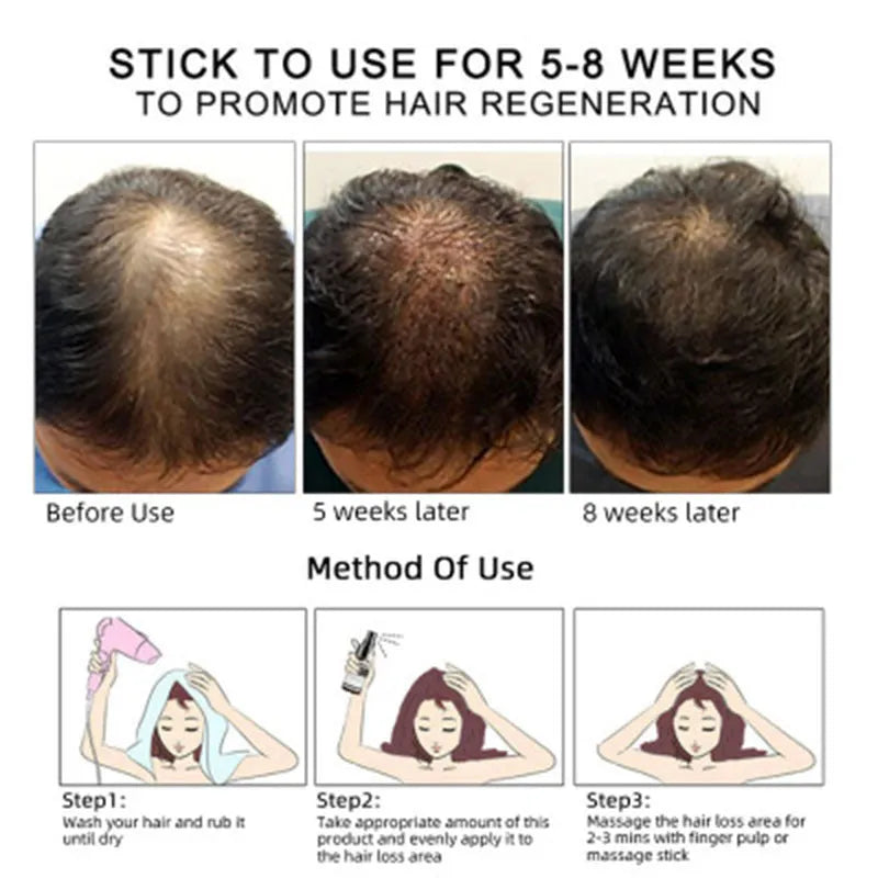 30ml hair growth oil bottle for scalp nourishment, hair strengthening, and hair loss prevention