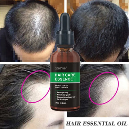 30ml hair growth oil bottle for scalp nourishment, hair strengthening, and hair loss prevention