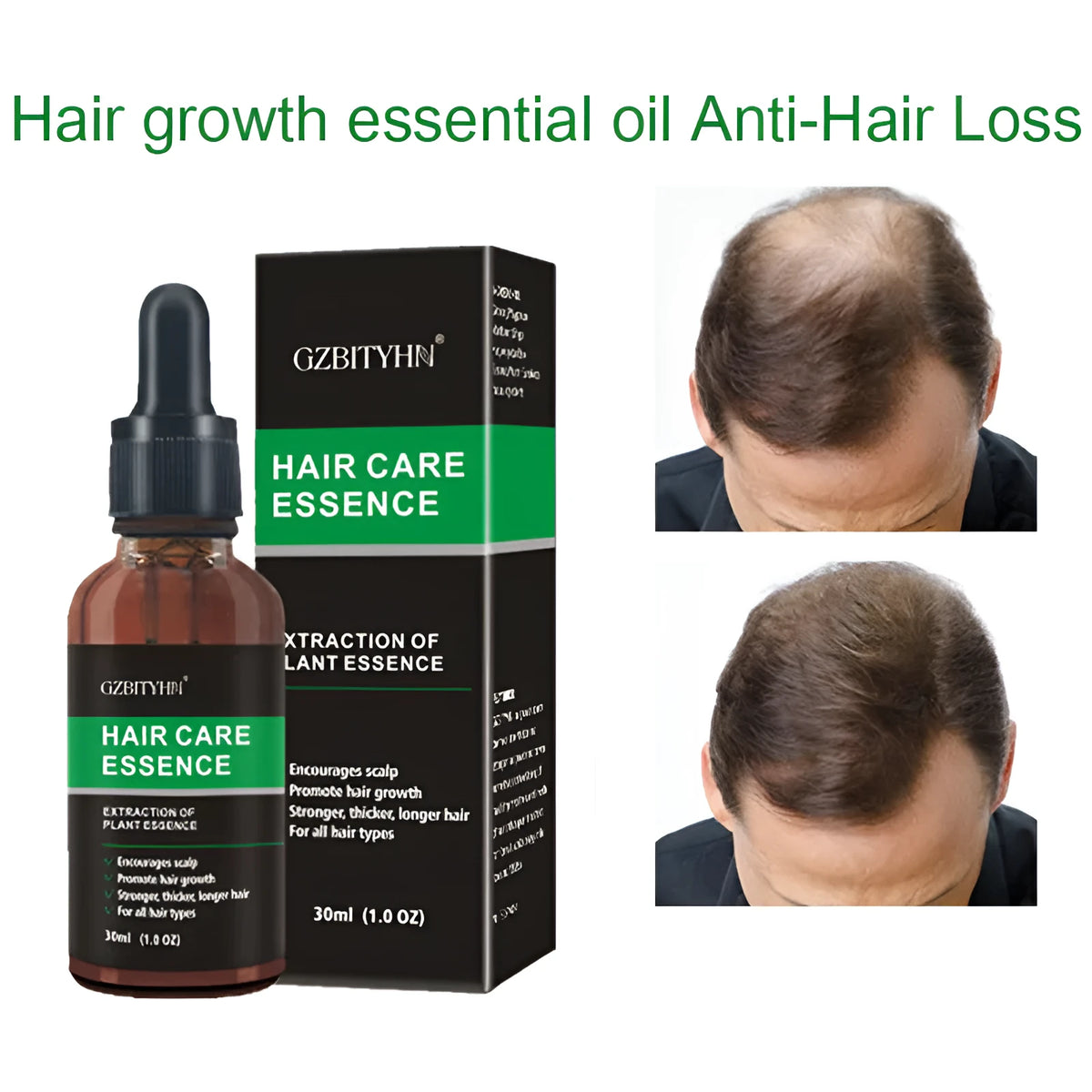 30ml hair growth oil bottle for scalp nourishment, hair strengthening, and hair loss prevention