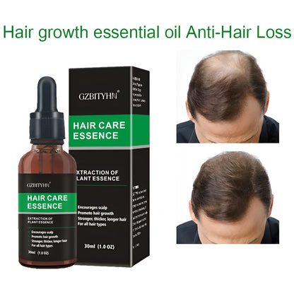 30ml hair growth oil bottle for scalp nourishment, hair strengthening, and hair loss prevention