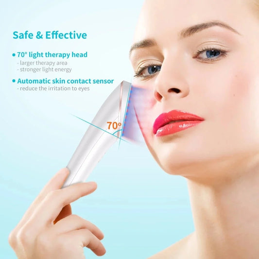 Xpreen Wireless Acne Light Therapy Device with blue and red light for clear skin