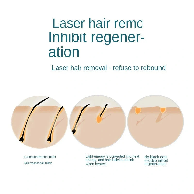 Home Hold Mini Hair Epilator IPL System for permanent hair removal