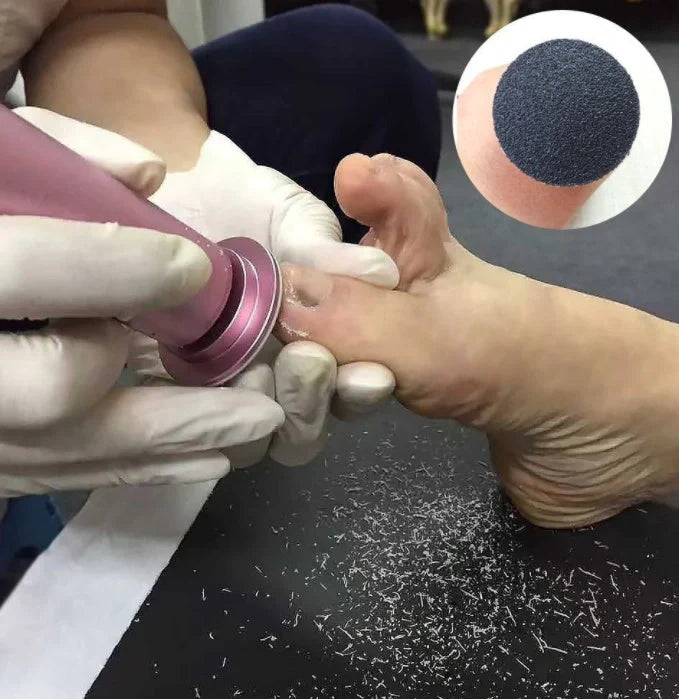 Rechargeable electric pedicure foot care tool with sandpaper disks for smooth feet