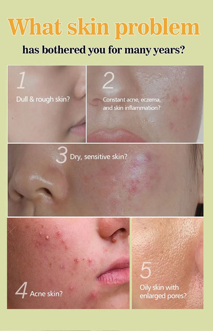 100g African Black Soap bar with deep cleansing and anti-mite properties