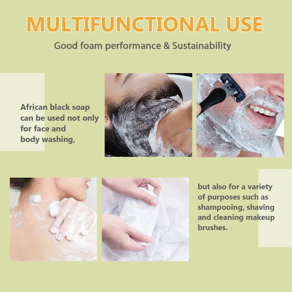 100g African Black Soap bar with deep cleansing and anti-mite properties