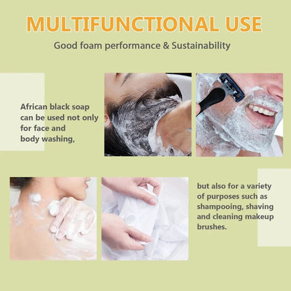 100g African Black Soap bar with deep cleansing and anti-mite properties