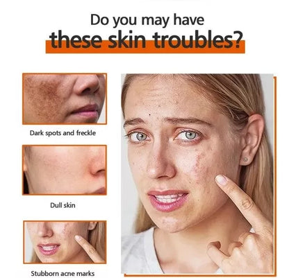 Kojic Acid Soap for skin brightening and freckle reduction, 65g x 2 bars