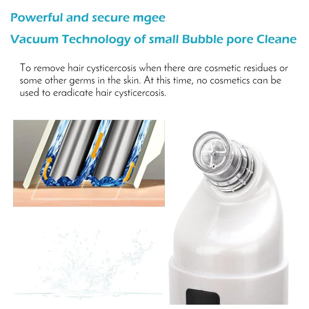 Electric Facial Cleaning Vacuum with multiple work heads and light therapy features