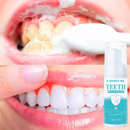 Teeth Whitening Mousse for Adults - 50ml compact whitening solution