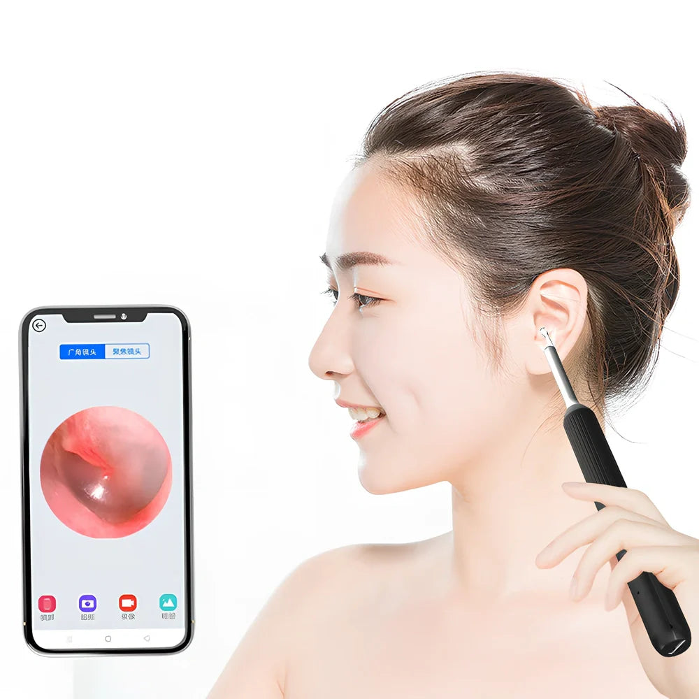 Visual ear cleaning device with camera, ear scoop attachments, and charging cable on white background