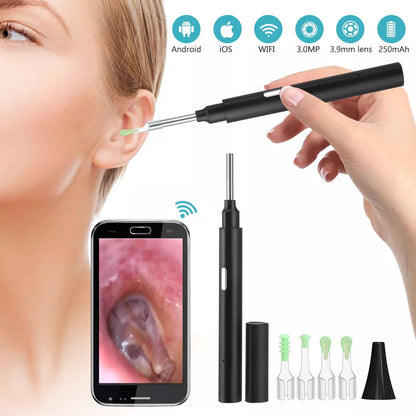 3.9mm Wireless WIFI Visual Otoscope for earwax cleaning with 3-million-pixel camera