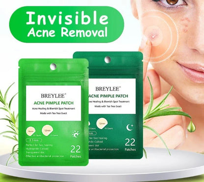 Tea Tree Acne Patches: Transparent, Ultra-Thin Design to Effectively Treat Blemishes and Fade Marks