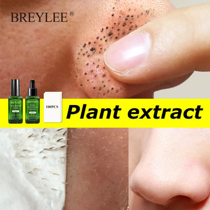 Blackhead Shrinking Combination Kit with Nasal Liquid and Serum for clear skin