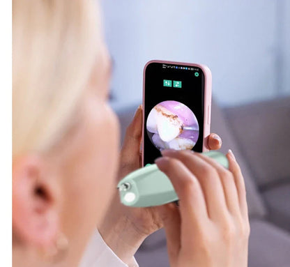 Ultrasonic Dental Plaque Remover with stainless steel and silicone construction, powerful vibrations, and USB charging