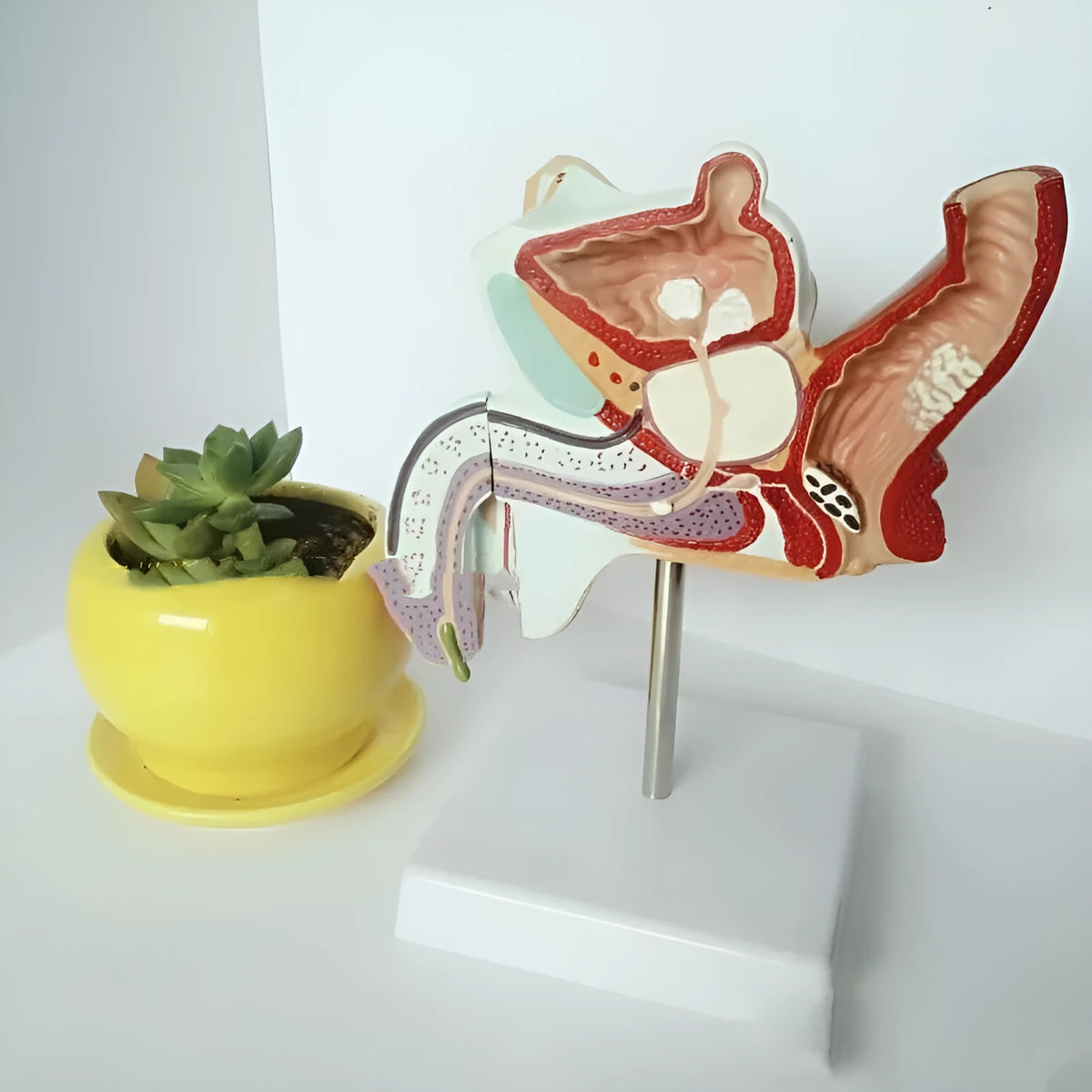 Male reproductive pathology anatomical model showing diseases in plastic construction