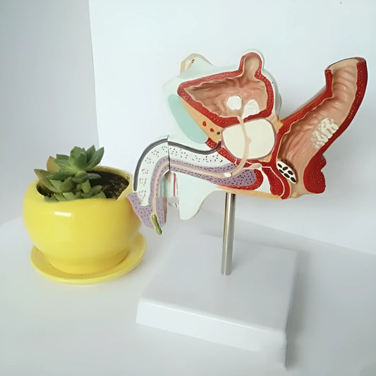 Male reproductive pathology anatomical model showing diseases in plastic construction