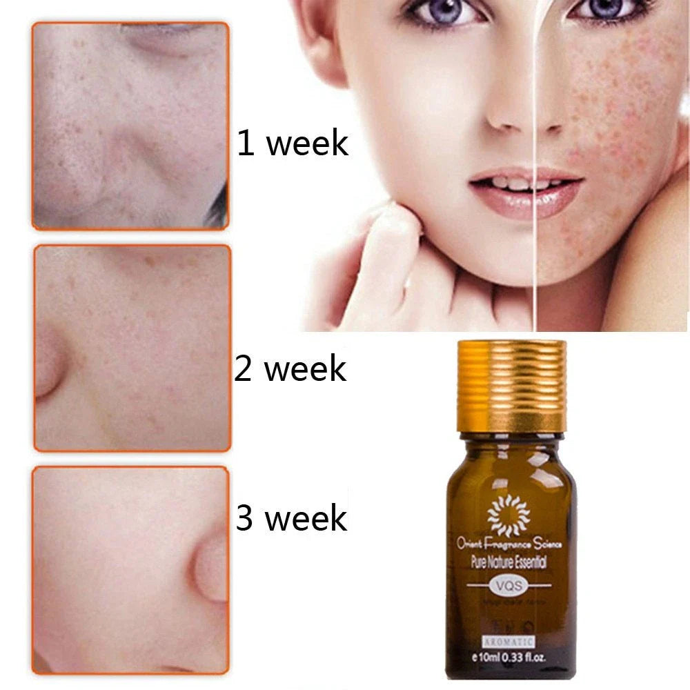 Ultra-Brightening Acne & Scar Removal Essence Oil - Visibly Diminish Dark Spots and Discoloration for Radiant, Even-Toned Skin