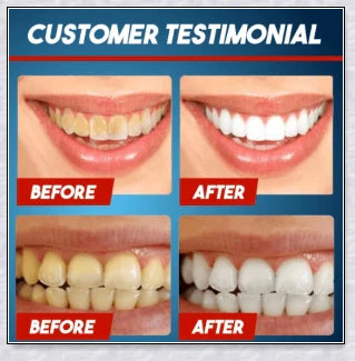 A tube of Intensive Stain Removal Whitening Toothpaste in Blueberry, Passion Fruit, and Blueberry + Passion Fruit flavors