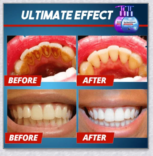 A tube of Intensive Stain Removal Whitening Toothpaste in Blueberry, Passion Fruit, and Blueberry + Passion Fruit flavors