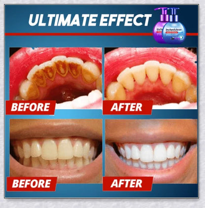 A tube of Intensive Stain Removal Whitening Toothpaste in Blueberry, Passion Fruit, and Blueberry + Passion Fruit flavors