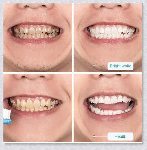 A tube of Intensive Stain Removal Whitening Toothpaste in Blueberry, Passion Fruit, and Blueberry + Passion Fruit flavors