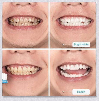 A tube of Intensive Stain Removal Whitening Toothpaste in Blueberry, Passion Fruit, and Blueberry + Passion Fruit flavors