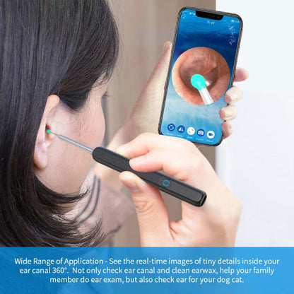 Wireless otoscope with 360-degree HD camera and LED light for safe and effective earwax removal