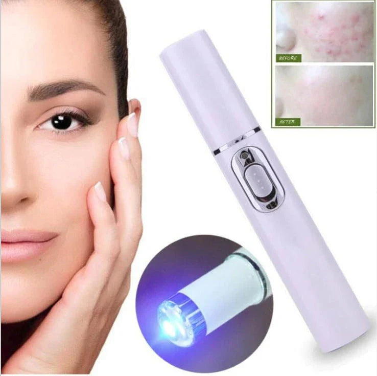 Portable blue light therapy acne and wrinkle remover pen with white body and blue light