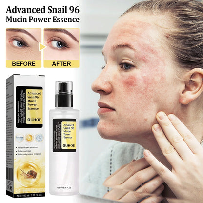 Luxurious Snail Collagen Facial Serum - Deeply Hydrating & Firming Formula for Radiant, Youthful-Looking Skin