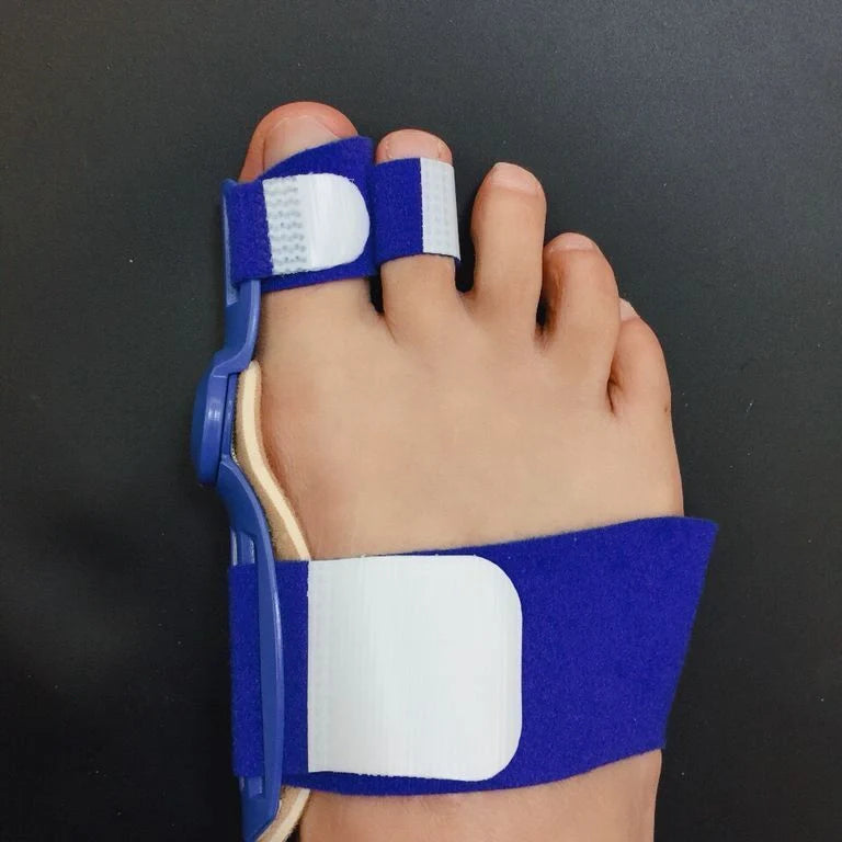Big Foot Valgus Corrector in skin tone and white, showcasing its lightweight design and protective cover.
