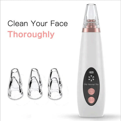 Microcrystalline Blackhead Remover with USB charging cable on white background