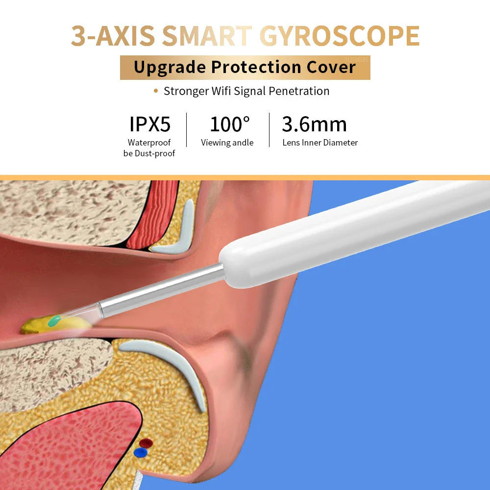 Wireless otoscope with 360-degree HD camera and LED light for safe and effective earwax removal