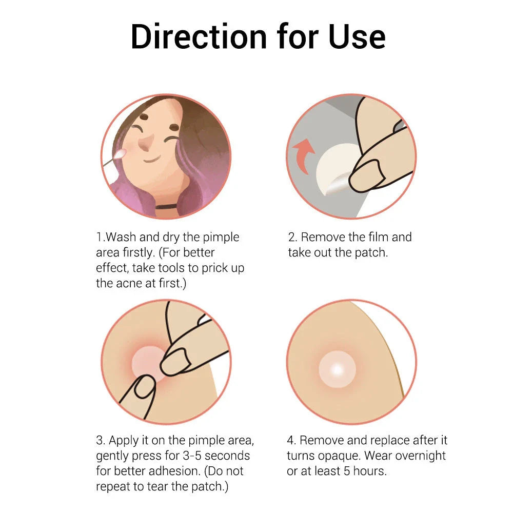 Tea Tree Acne Patches: Transparent, Ultra-Thin Design to Effectively Treat Blemishes and Fade Marks