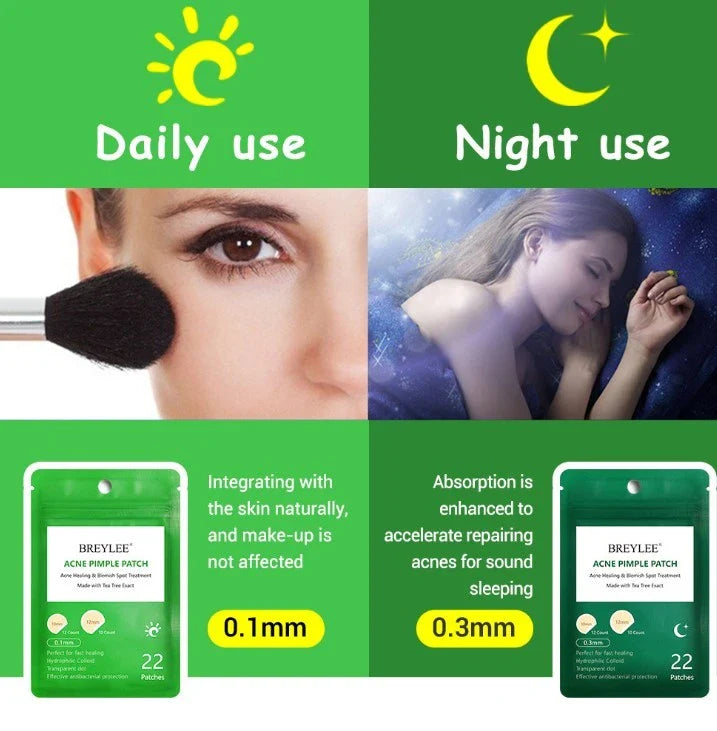 Tea Tree Acne Patches: Transparent, Ultra-Thin Design to Effectively Treat Blemishes and Fade Marks