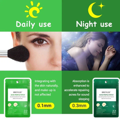 Tea Tree Acne Patches: Transparent, Ultra-Thin Design to Effectively Treat Blemishes and Fade Marks