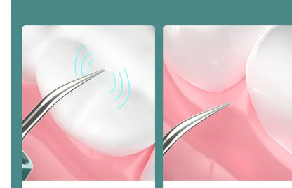 Ultrasonic Dental Plaque Remover with stainless steel and silicone construction, powerful vibrations, and USB charging