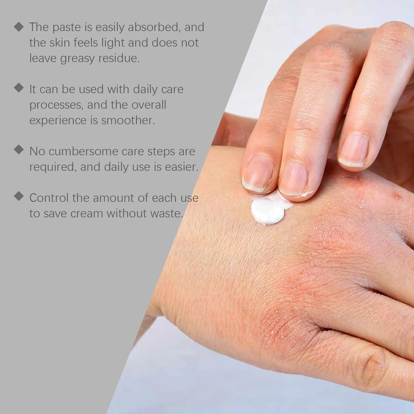 75g container of skin repair cream for neck treatment with bifidobacterium and mint extracts
