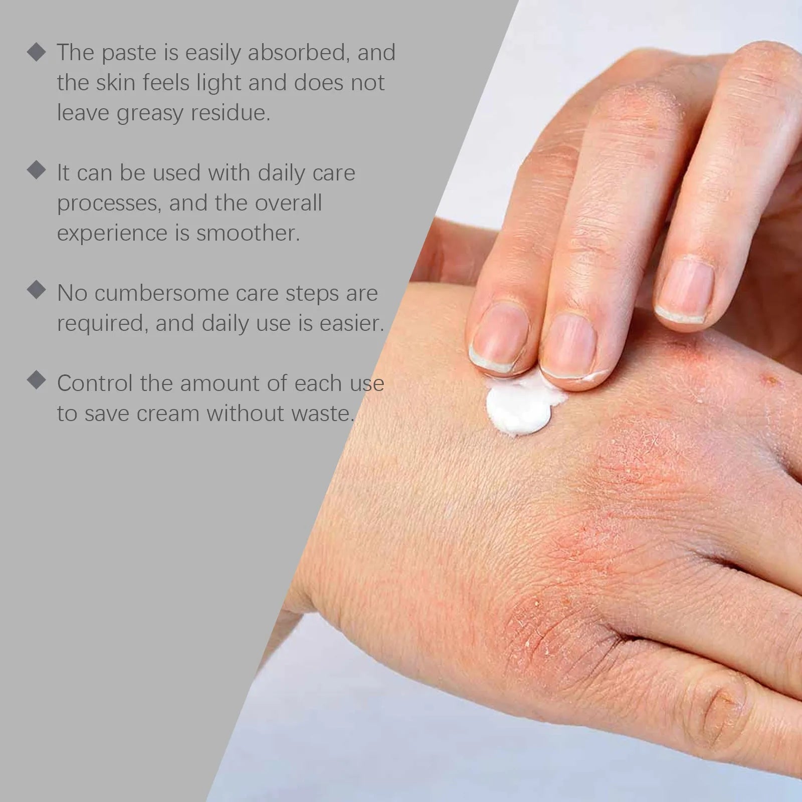 75g container of skin repair cream for neck treatment with bifidobacterium and mint extracts