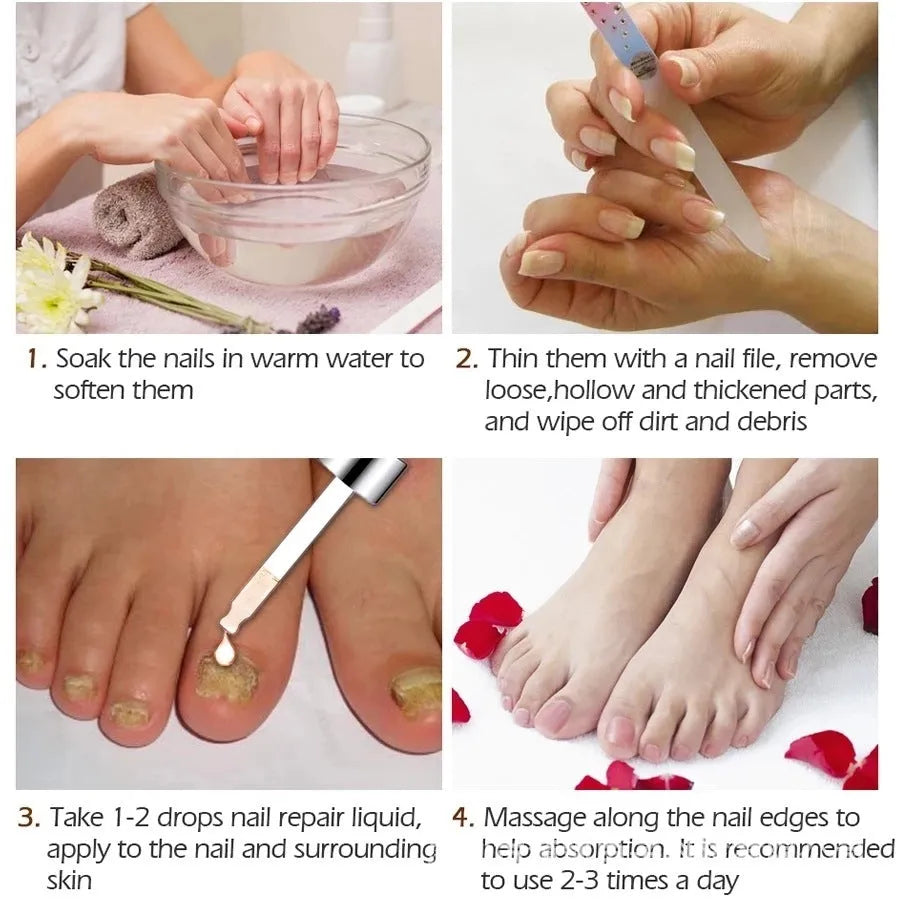 10ml bottle of Jiagou Whitening Antibacterial Liquid foot treatment