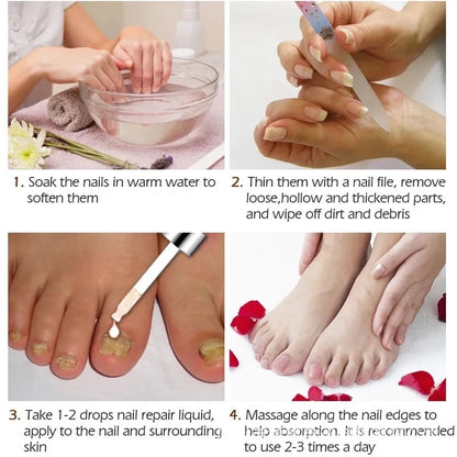 10ml bottle of Jiagou Whitening Antibacterial Liquid foot treatment