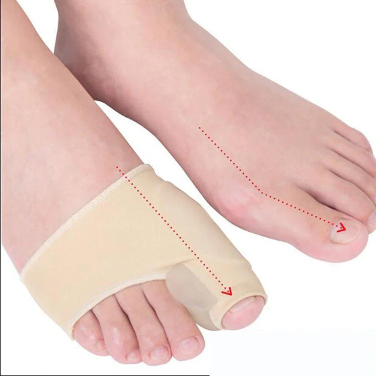 Big Foot Valgus Corrector in skin tone and white, showcasing its lightweight design and protective cover.