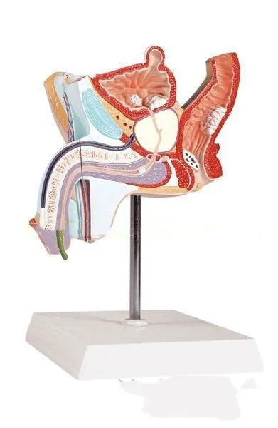 Male reproductive pathology anatomical model showing diseases in plastic construction