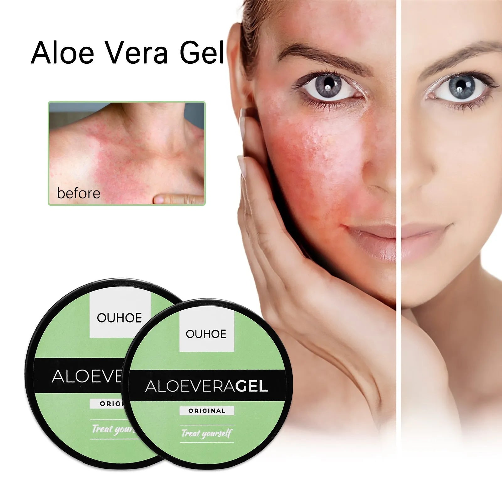 Tanning cream and aloe vera gel set for natural bronzing with after sun repair