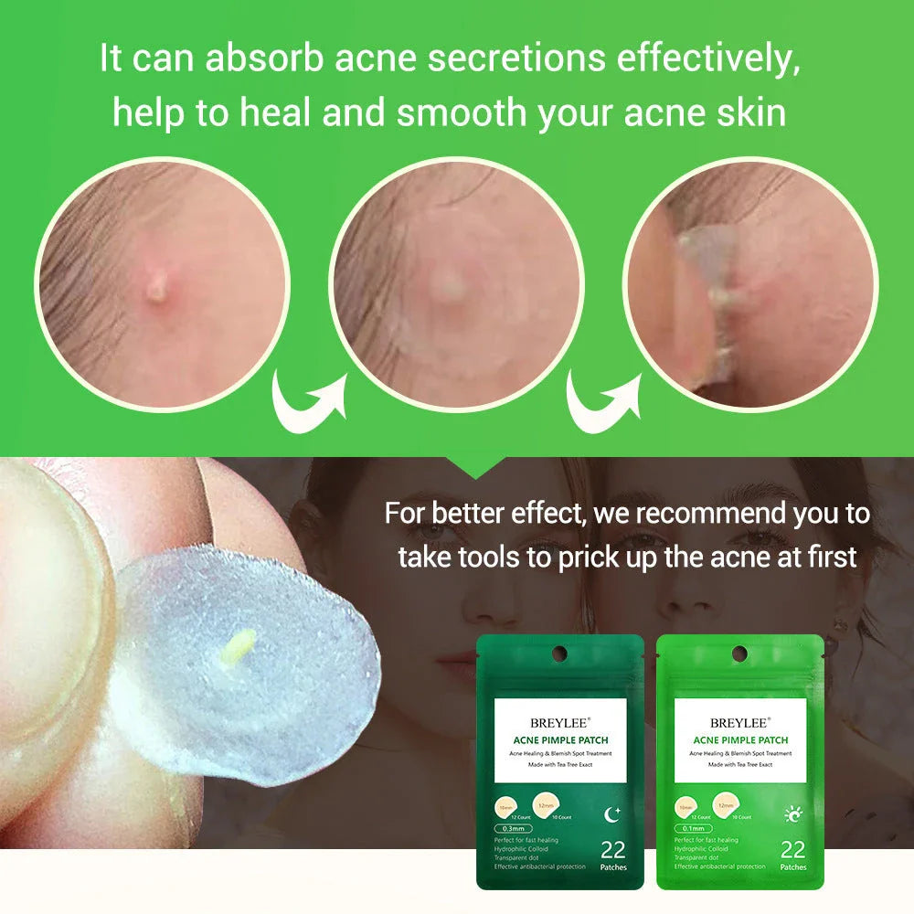 Tea Tree Acne Patches: Transparent, Ultra-Thin Design to Effectively Treat Blemishes and Fade Marks
