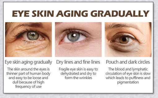 Magic Eye Cream that instantly reduces bags, dark circles, and wrinkles in just 28 seconds for youthful, radiant under-eye skin